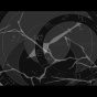 Hundreds of Roads