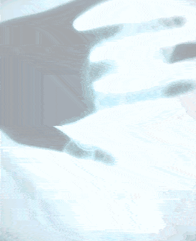 PARASOMNIA